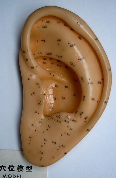 Auriculoterapia na orelha direita